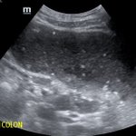 Photo by UT Southwestern EM Ultrasound (@DallasSono)