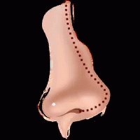 Plastic Surgery Beauty GIF
