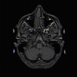 Mri Brain GIF