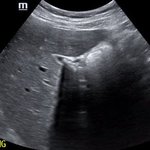 Photo by UT Southwestern EM Ultrasound (@DallasSono)