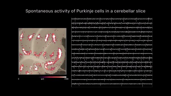 *$ Aktivitätsaufnahme ('Recording') von einem Cerebellum Hi