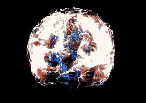 Brain Neuroscience GIF by U...