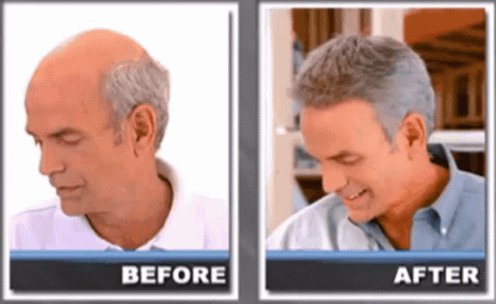 Hair Club Hair Restoration GIF