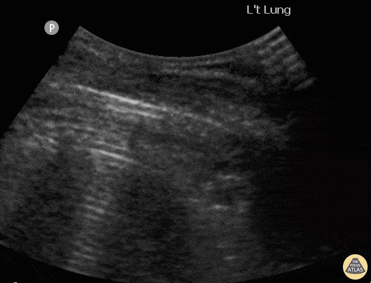 Zaven Sargsyan Sargsyanz Twitter