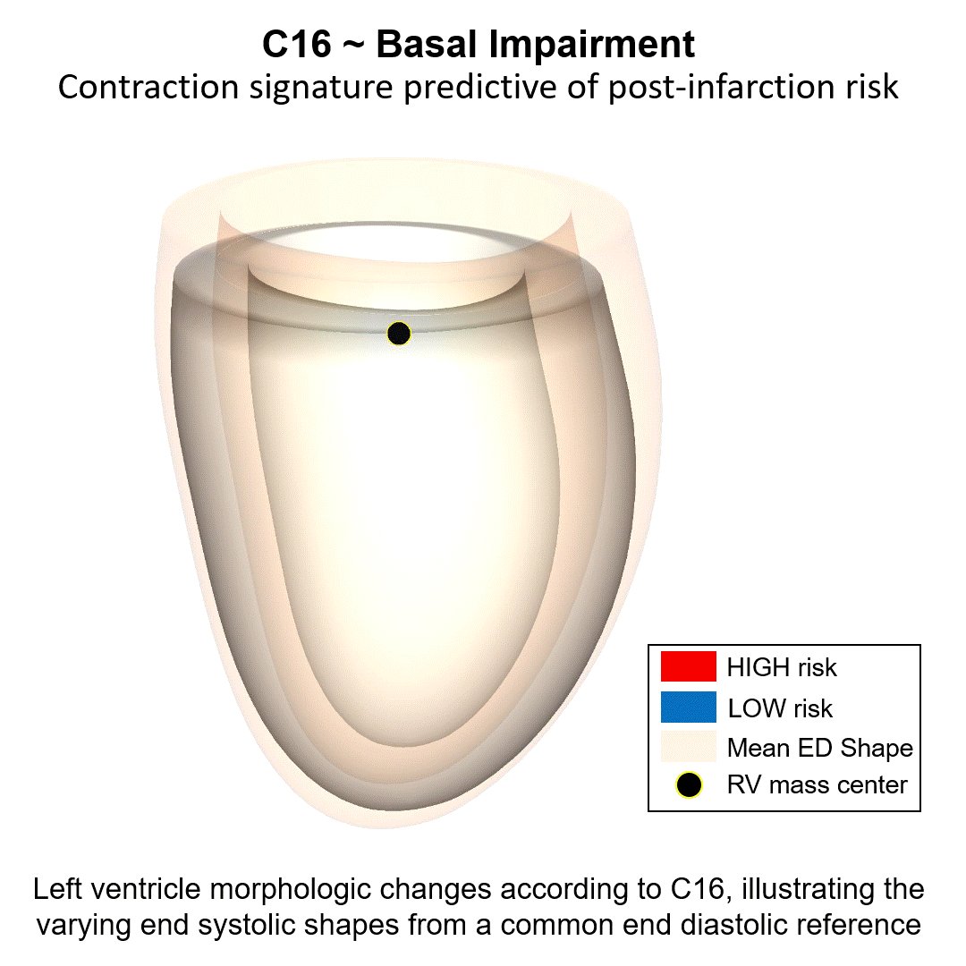 JACC Journals on Twitter "Automated whyCMR cardiac 3D shape