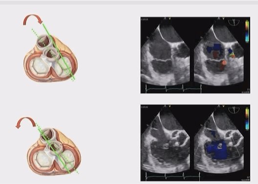 Ritu Thamman MD on Twitter: 