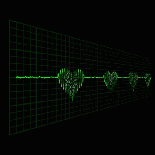 Ekg Heart Rate GIF