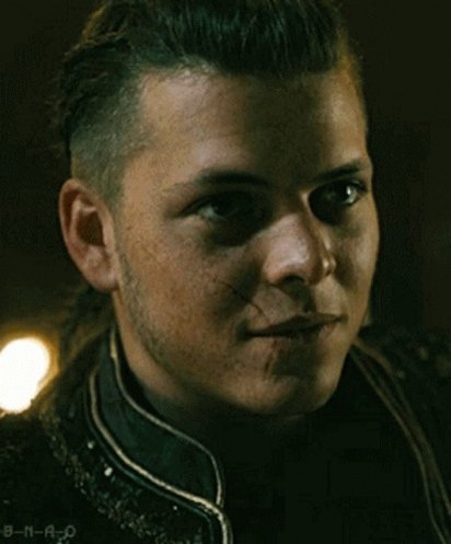 Vikings' Season 5: Alex Hogh Anderson (a.k.a. Ivar the Boneless